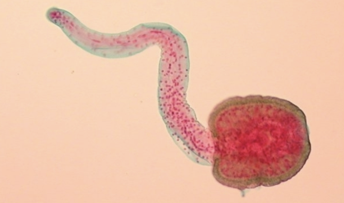 <p>What stage of the fluke life cycle is this fluke at?</p>