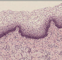 <p>what is this epithelium histologically?</p>