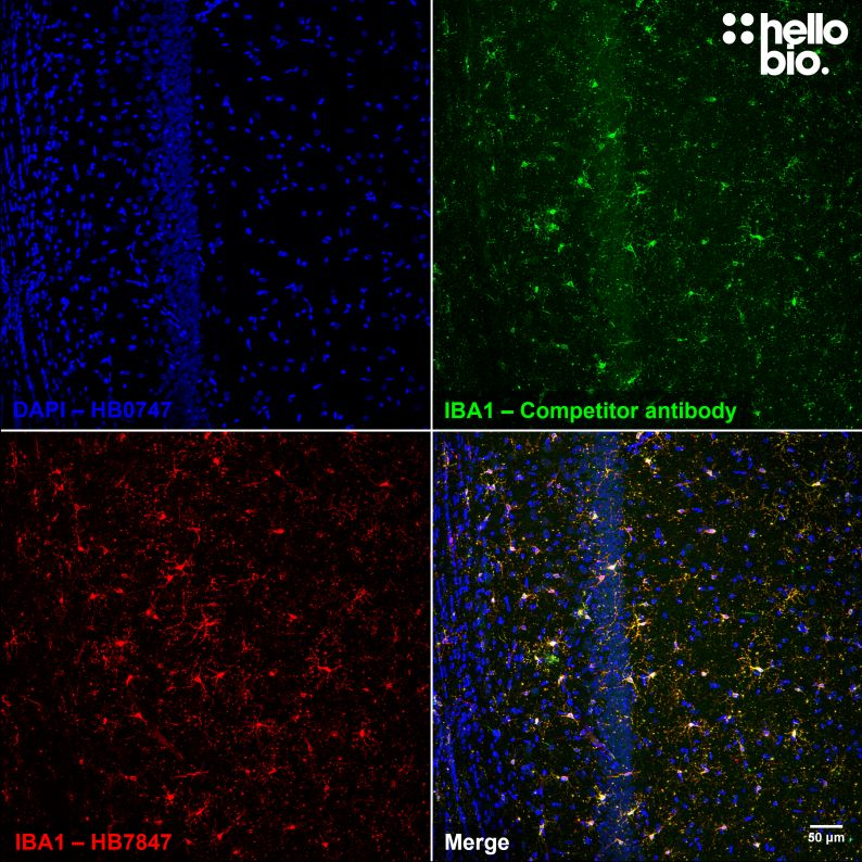 <p>Microglia (also some related myeloid cells) </p>