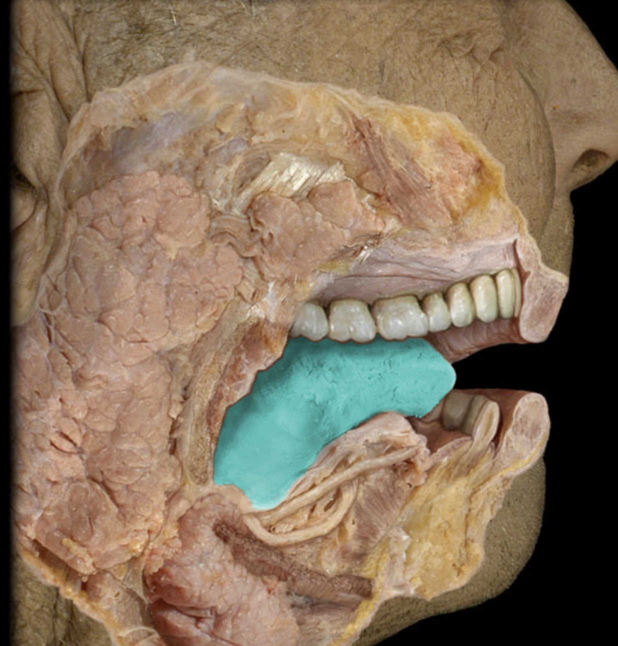 term image