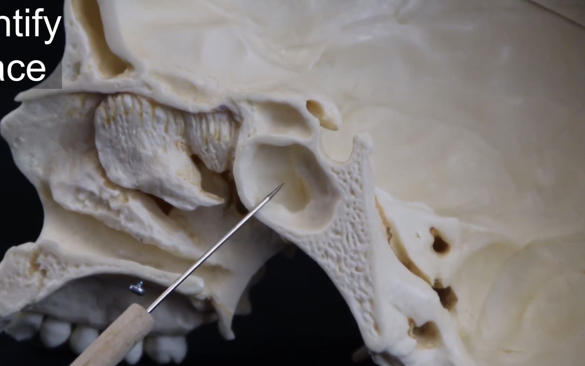 <p>What bone is this?</p>