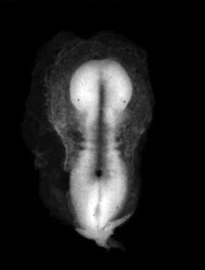 <p>Label the following:</p><ul><li><p>neural plate</p></li><li><p>neural groove</p></li><li><p>primitive streak</p></li></ul><p></p>