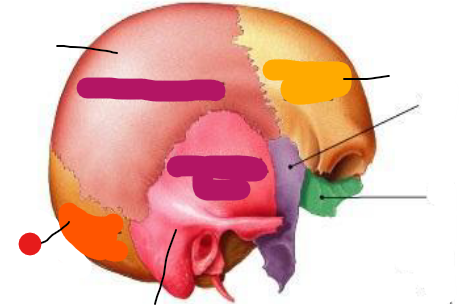 <p>Identify the structure pinned</p>