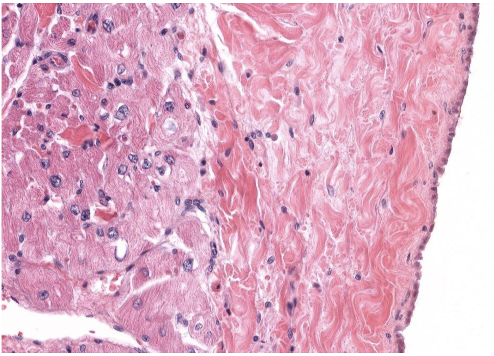 <p>Identify Which partition this is and Where?</p>