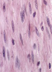 <p>This is a longitudinal orientation of what muscle type?</p>