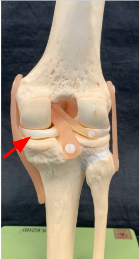 <p>Pad of fibrocartilage between the medial condyle of the femur and the medial condyle of the tibia</p>