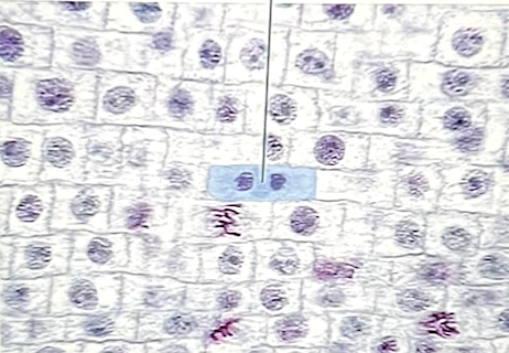 <p>Identify the stage of mitosis</p>