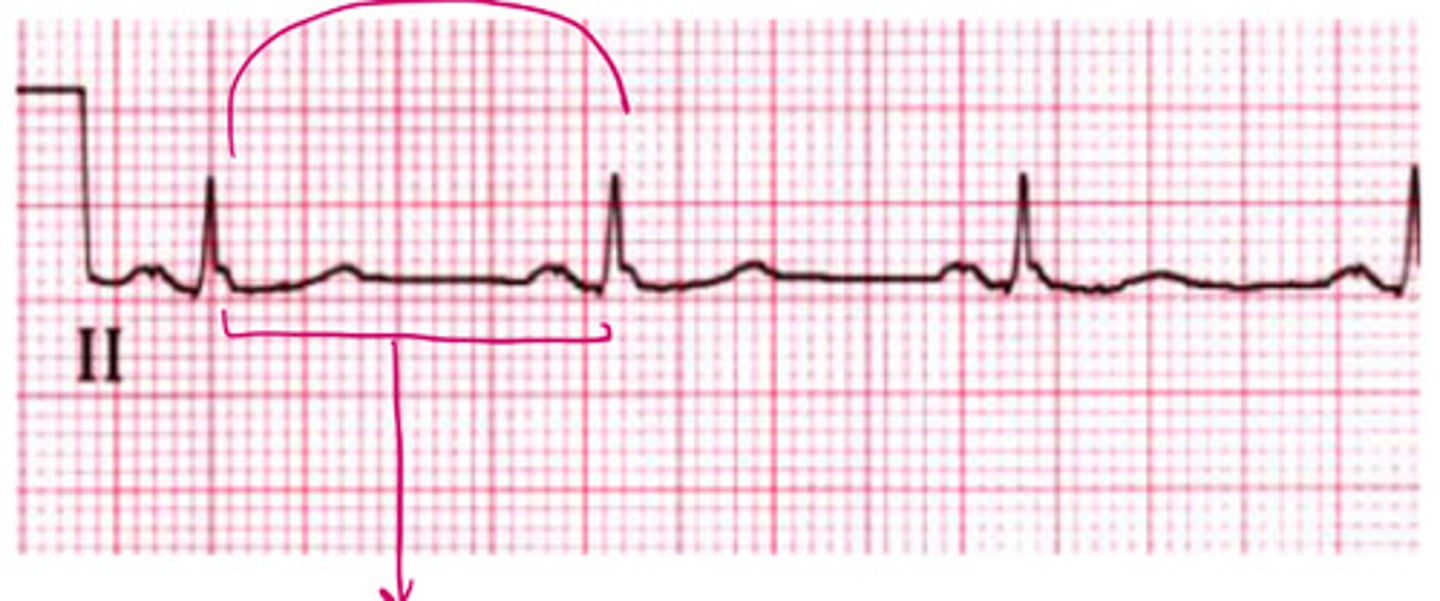 <p>what is the HR of this</p>