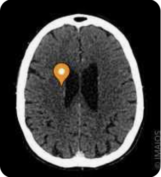 <p>Name the major white matter tract, modality, and plane</p>