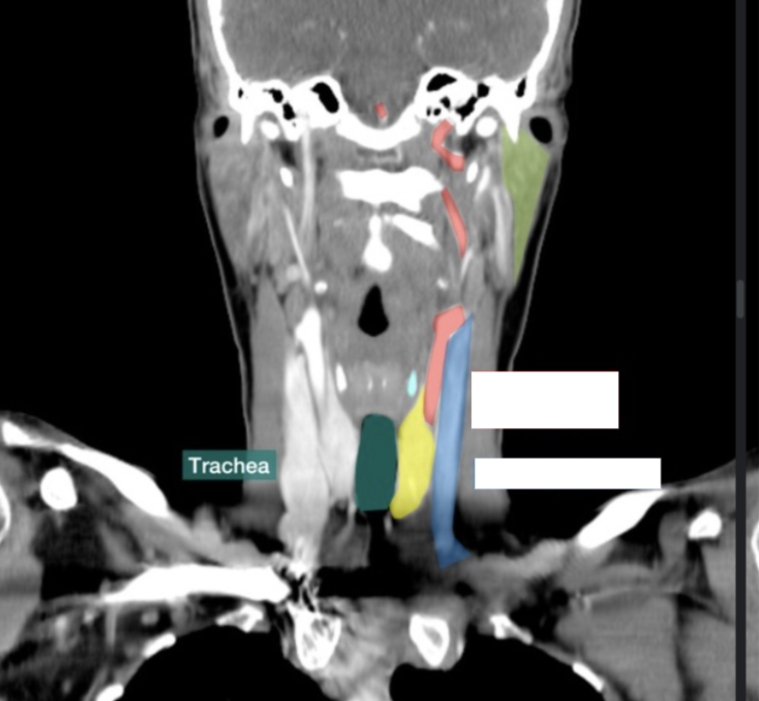 <p>What is this artery and vein? </p>