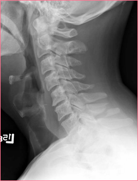 <p>What is the diagnosis?</p>