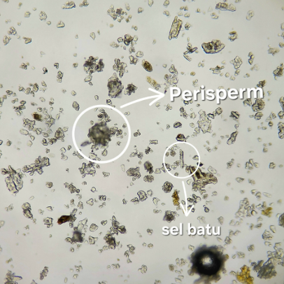<p>p</p>