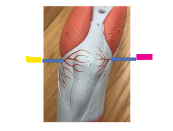 <p>What is the pink arrow?</p>