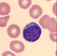 <p>nRBC or lymph?</p>