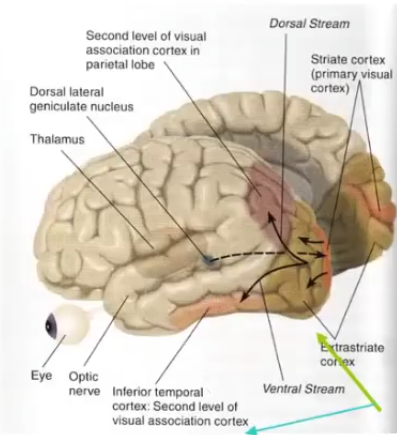 <ul><li><p><span style="font-family: "Arial Nova Light";">Interest in a visual basis for dyslexia was re-ignited in the 70s and 80s, when it was demonstrated that many dyslexic readers show a deficit in processing visual info carried by </span><span style="background-color: rgb(255, 153, 204); font-family: "Arial Nova Light";">dorsal stream</span><span style="font-family: "Arial Nova Light";"> of visual system (this part isn't normally measured by optometrists). Called transient deficit theory of dyslexia, then magno-deficit theory of dyslexia, </span><span style="background-color: rgb(255, 153, 204); font-family: "Arial Nova Light";">dorsal stream deficit theory of dyslexia</span><span style="font-family: "Arial Nova Light";">.</span></p></li><li><p><span style="font-family: "Arial Nova Light";">Process of reading in dyslexia.</span></p></li><li><p><span style="font-family: "Arial Nova Light";">Eye fixation pattern differs in a characteristic way from those of normal readers. Dyslexic readers fixate longer on words (and saccades are shorter) and demonstrate more regressive eye movements. Fixations are less stable in dyslexic readers. Abnormal eye movements, compared to normal readers. Poor binocular convergence.</span></p></li><li><p><span style="font-family: "Arial Nova Light";">We have two pathways from the eyes to the visual cortex- </span><span style="background-color: rgb(255, 153, 204); font-family: "Arial Nova Light";">dorsal</span><span style="font-family: "Arial Nova Light";"> (magno cells) and </span><span style="background-color: rgb(255, 153, 204); font-family: "Arial Nova Light";">ventral</span><span style="font-family: "Arial Nova Light";"> pathways (parvo cells). Each of these carries different types of information.</span></p></li><li><p><span style="font-family: "Arial Nova Light";">Ventral stream: colour sensitive, detail, movement insensitive, higher contrast, slow. The what and where, the details.</span></p></li><li><p><span style="font-family: "Arial Nova Light";">Dorsal stream: colour insensitive, global form, movement sensitive, spatial processing, lower contrast, fast.</span></p></li><li><p><span style="font-family: "Arial Nova Light";">Evolutionarily, when something is new and catches your attention, it picks up movement (dorsal stream), reporting that something is there. Then ventral stream kicks in, it's slower, and gives the detail (it's a leopard over there).</span></p></li><li><p><span style="font-family: "Arial Nova Light";">Yet it's dorsal stream that's impaired. They have difficulty processing info that needs to be transmitted by dorsal stream. Doesn't make sense why it's not ventral stream.</span></p></li></ul><p></p>