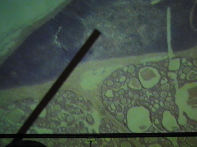 <p>Identify?</p><p>Lab Image 6-15</p>