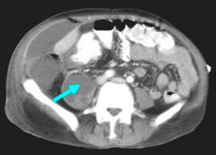 <p>identify the pathology</p>