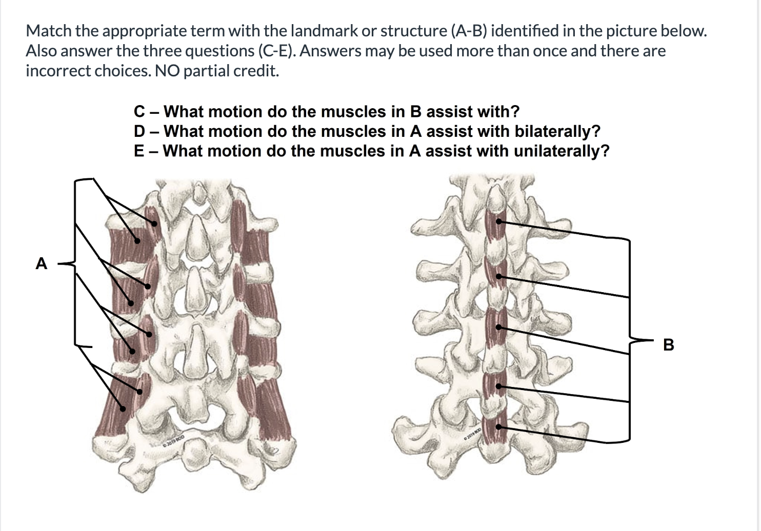 <p><span>Match the appropriate term with the landmark or structure (A-B) identified in the picture below. Also answer the three questions (C-E). Answers may be used more than once and there are incorrect choices. NO partial credit.</span></p>
