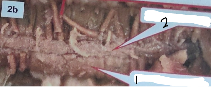 <p>What is point 2 on the earthworm</p>