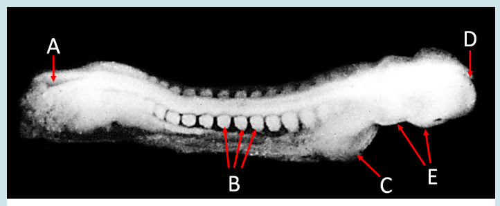 <ol><li><p>Label A, B, C, D, and E</p></li><li><p>What view is this?</p></li><li><p>What is the next developmental process?</p></li></ol><p></p>