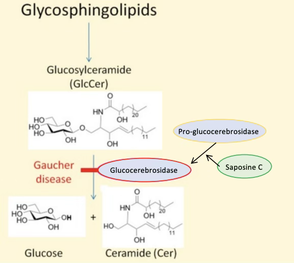 <ul><li><p>Caused by mutations glucocerebrosidase or its activator, saposin C, which are enzymes that normally conjugate Glucosylceramide into glucose and ceramide</p></li><li><p>Results in accumulation of glycosylceramide in macrophages&nbsp;</p></li><li><p>Macrophages infiltrate bone marrow, spleen, and liver</p></li><li><p>Symptoms vary, but can include enlargement of spleen and liver, anemia, and bone necrosis due to vascular compression in the bone</p></li></ul><p></p>
