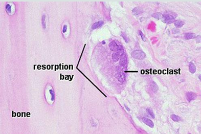 <ul><li><p>Release acid, collagenase , and other lytic enzymes to break down bone matrix and release minerals (bone resorption).</p></li><li><p><strong>Osteoclasts:</strong><span> Large, multinucleated cells responsible for </span>bone resorption<span> (breaking down matrix); they sit in </span>Howship's lacunae</p></li></ul><p></p>