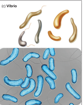 <p>what type? </p>