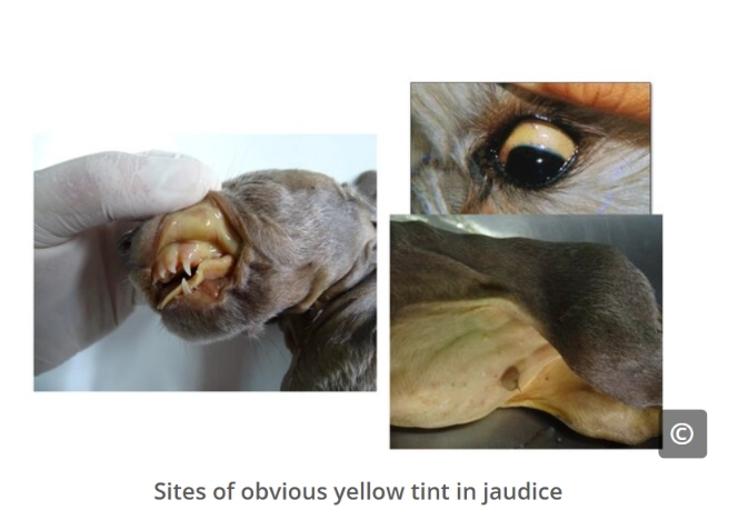 <p><span><strong>Jaundice</strong></span>/<strong>I</strong><span><strong>cterus</strong></span></p><ul><li><p>The yellow discolouration of body tissue</p></li></ul><p></p>