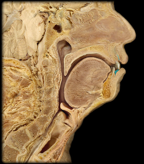 <p>space between the teeth and the lips or cheeks</p>