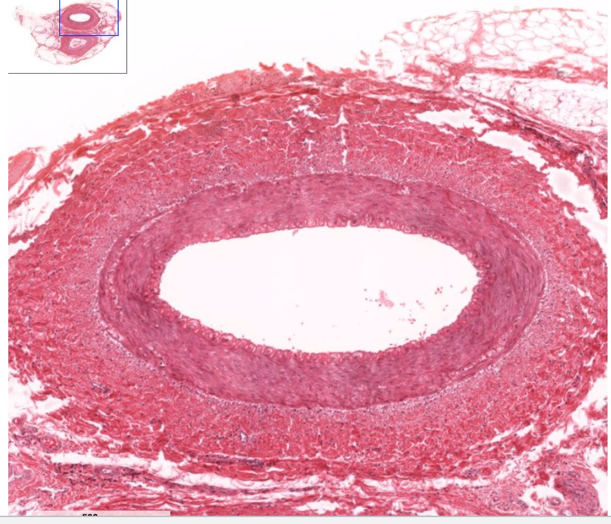 <p>What are muscular arteries?</p>