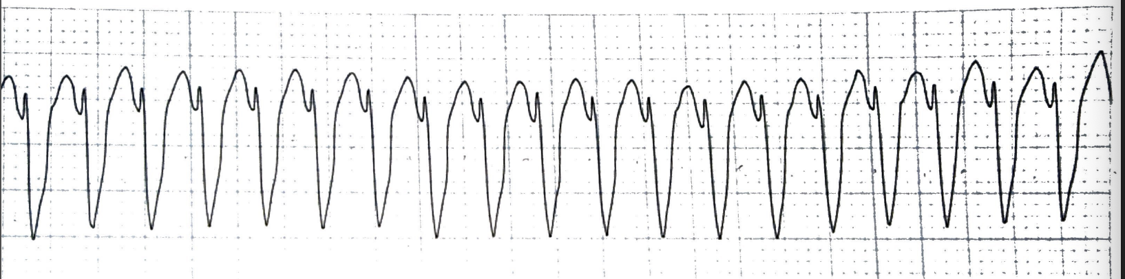 <p>What rhythm is this + bpm</p>