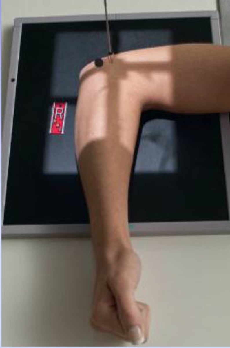 <p>S - on lap</p><p>T - 6 mAs @ 66 kVp</p><p>A - none</p><p>M - correct arm, on cassette</p><p>P -90 degree bend of the elbow, distal humerus and proximal forearm included, CR mid elbow</p><p>S - 40"</p><p>B - hold</p><p>C - 10 by 12</p>