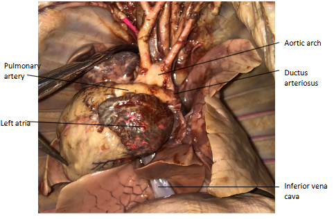 <p>The ductus arteriosus because since the lungs in a fetal animal are non-functional, mothers provides oxygenated blood via the umbilical vein which then empties into the inferior vena cava. The ductus arteriosus shunts blood away from the lungs and back into the blood.</p>