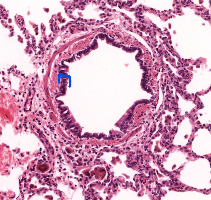 <p>identify the layer of mucosa </p>