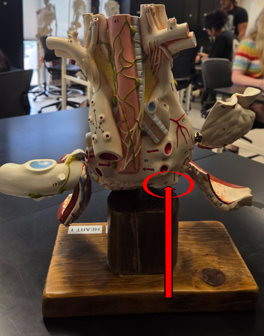 <p>What great vessel is the arrow pointing to?</p>