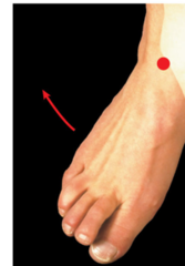 <p>Turning the sole of the foot outward.</p>