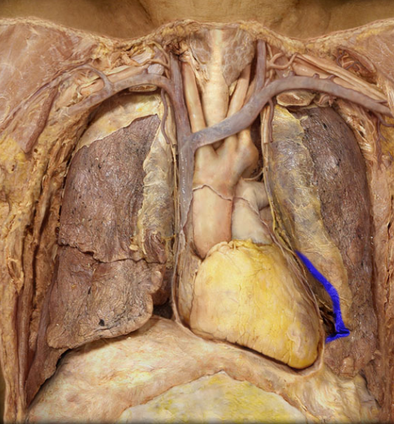 <p>only on left </p>