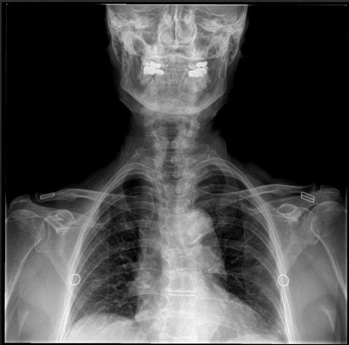 <p>Is this film of diagnostic quality (APOM Cervical)</p>