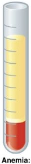 <p>what is it (Abnormalities)</p>