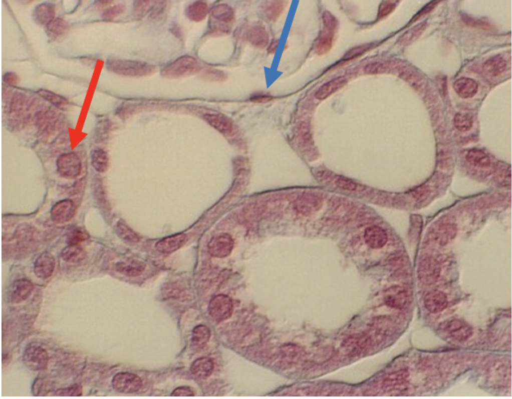 <p>Identify the epithelial type seen at the tip of the blue arrow</p>