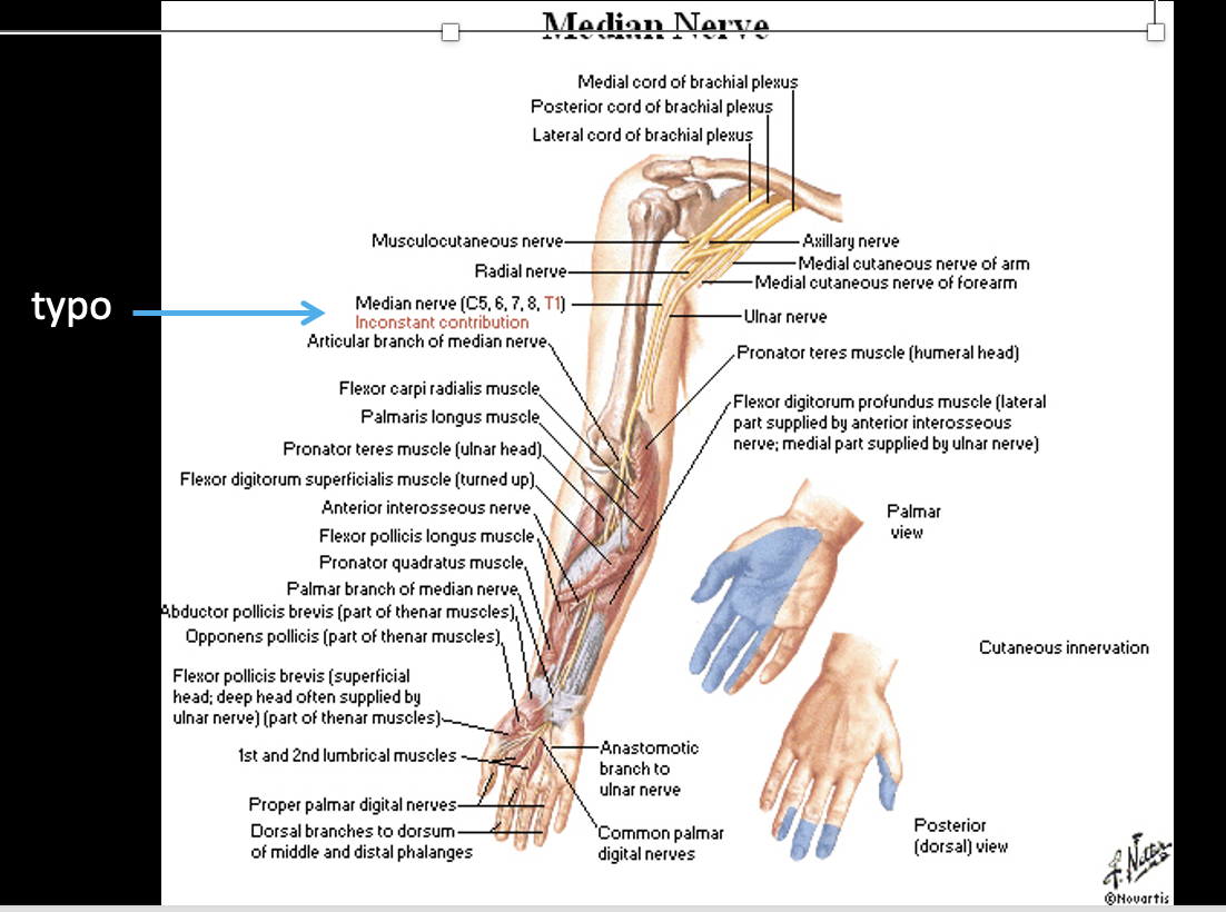 <p>-(C5)C6-T1</p><p>-Medial and Lateral cords (*only one w/ multiple cords)</p><p>-Anterior division;<mark data-color="red" style="background-color: red; color: inherit;"> all Trunks</mark></p><p>-Motor to most anterior forearm muscles, thenar muscles (*1,2,3, ~4; palmar and nailbeds)</p><p>-Sensory to lateral, palmar hand and dorsum of digits (see diagram)</p>