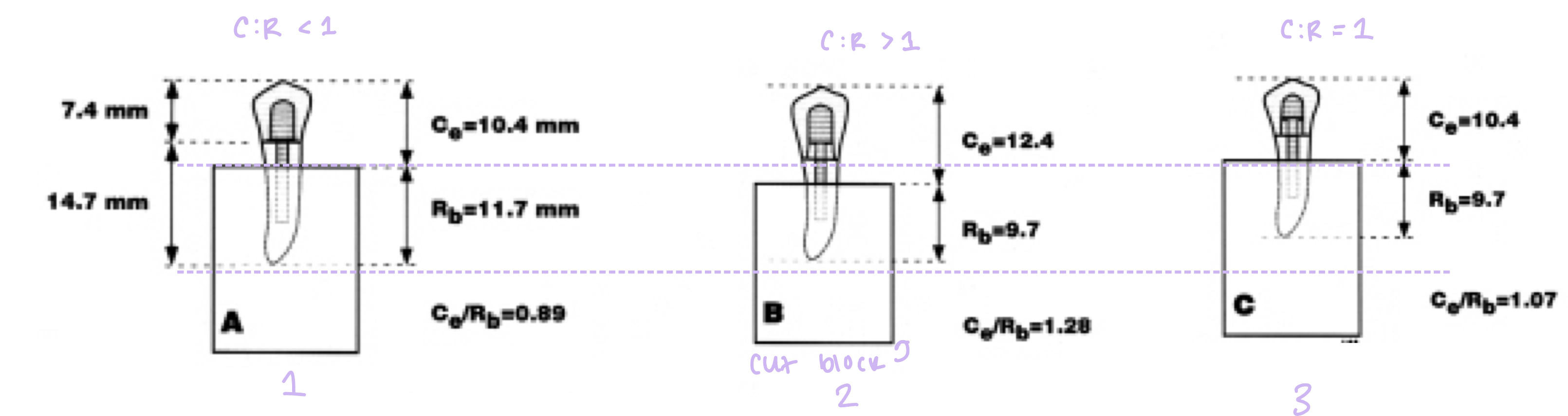 <p>which two options have higher fracture resistance compared to the other and why?</p>