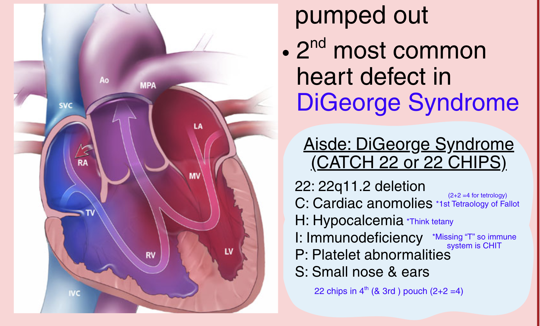 <p><span style="color: rgba(59,0,255,var(--O42jJQ,1));">Aorticopulmonary septum incomplete</span><span style="color: rgba(0,0,0,var(--O42jJQ,1));"> ⟶ so oxygenated blood from LV & deoxygenated blood from RV mix</span></p><p><span style="color: rgba(0,0,0,var(--O42jJQ,1));">2nd most common heart defect in </span><span style="color: rgba(59,0,255,var(--O42jJQ,1));">DiGeorge Syndrome (22 Chips)</span></p><ul><li><p><span style="color: rgba(0,0,0,var(--O42jJQ,1));">22: 22q11.2 deletion</span></p></li><li><p class="cvGsUA block-font-kerning-normal block-font-feature-liga-off block-font-feature-clig-off block-font-feature-calt-off direction-ltr align-start para-style-body"><span style="color: rgba(0,0,0,var(--O42jJQ,1));">C: Cardiac anomalies (1st Tetralogy of Fallot. Think 2+ 2 = 4)</span></p></li><li><p class="cvGsUA block-font-kerning-normal block-font-feature-liga-off block-font-feature-clig-off block-font-feature-calt-off direction-ltr align-start para-style-body"><span style="color: rgba(0,0,0,var(--O42jJQ,1));">H: Hypocalcemia</span></p></li><li><p class="cvGsUA block-font-kerning-normal block-font-feature-liga-off block-font-feature-clig-off block-font-feature-calt-off direction-ltr align-start para-style-body"><span style="color: rgba(0,0,0,var(--O42jJQ,1));">I: Immunodeficiency</span></p></li><li><p class="cvGsUA block-font-kerning-normal block-font-feature-liga-off block-font-feature-clig-off block-font-feature-calt-off direction-ltr align-start para-style-body"><span style="color: rgba(0,0,0,var(--O42jJQ,1));">P: Platelet abnormalities</span></p></li><li><p class="cvGsUA block-font-kerning-normal block-font-feature-liga-off block-font-feature-clig-off block-font-feature-calt-off direction-ltr align-start para-style-body"><span style="color: rgba(0,0,0,var(--O42jJQ,1));">S: Small nose & ears</span></p></li></ul><p></p>