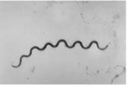 <p>Spirochete (pl. spirochetes)</p>