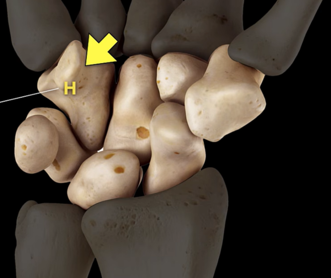 term image