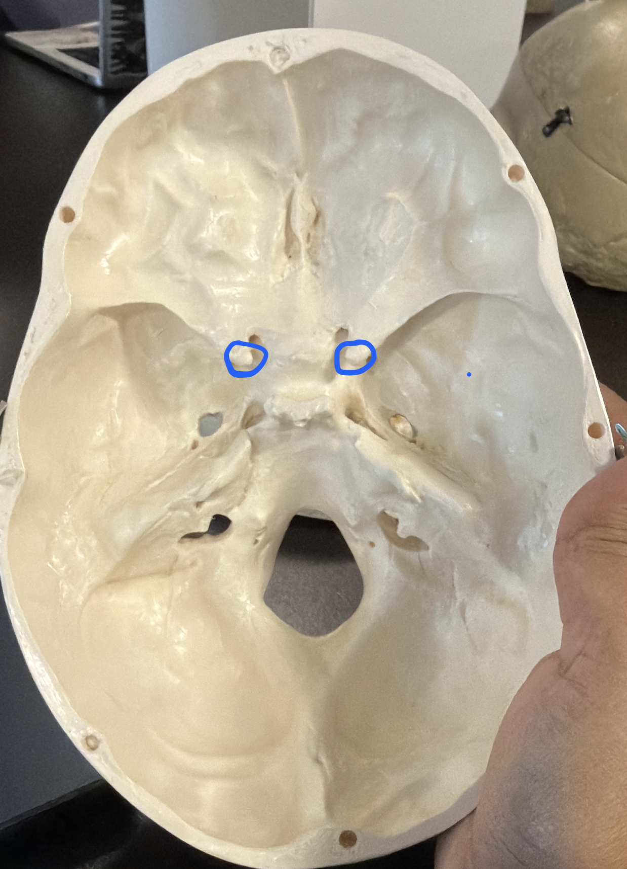 <p>anterior projections of the sella turcica region</p>