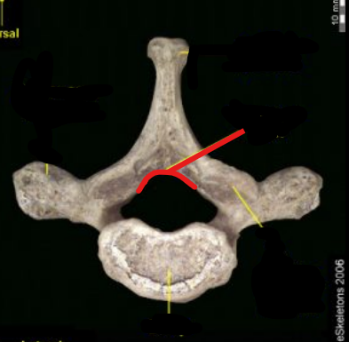 <p>What part of the vertebrae is this?</p>