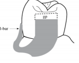 <p>What is the component shown </p>