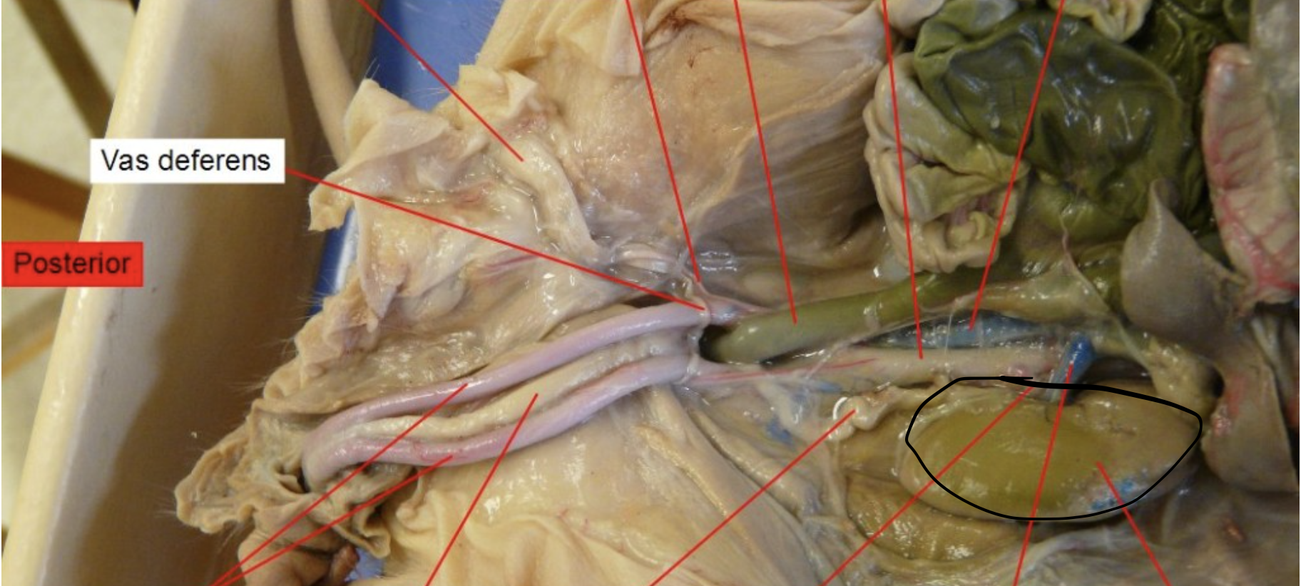 <p>Identify this Organ</p>