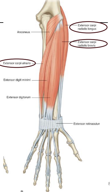 <p><strong>Posterior Forearm Muscle-</strong> Extensor carpi radialis Longus (ECRL) / Extensor carpi radialis brevis (ECRB)</p>